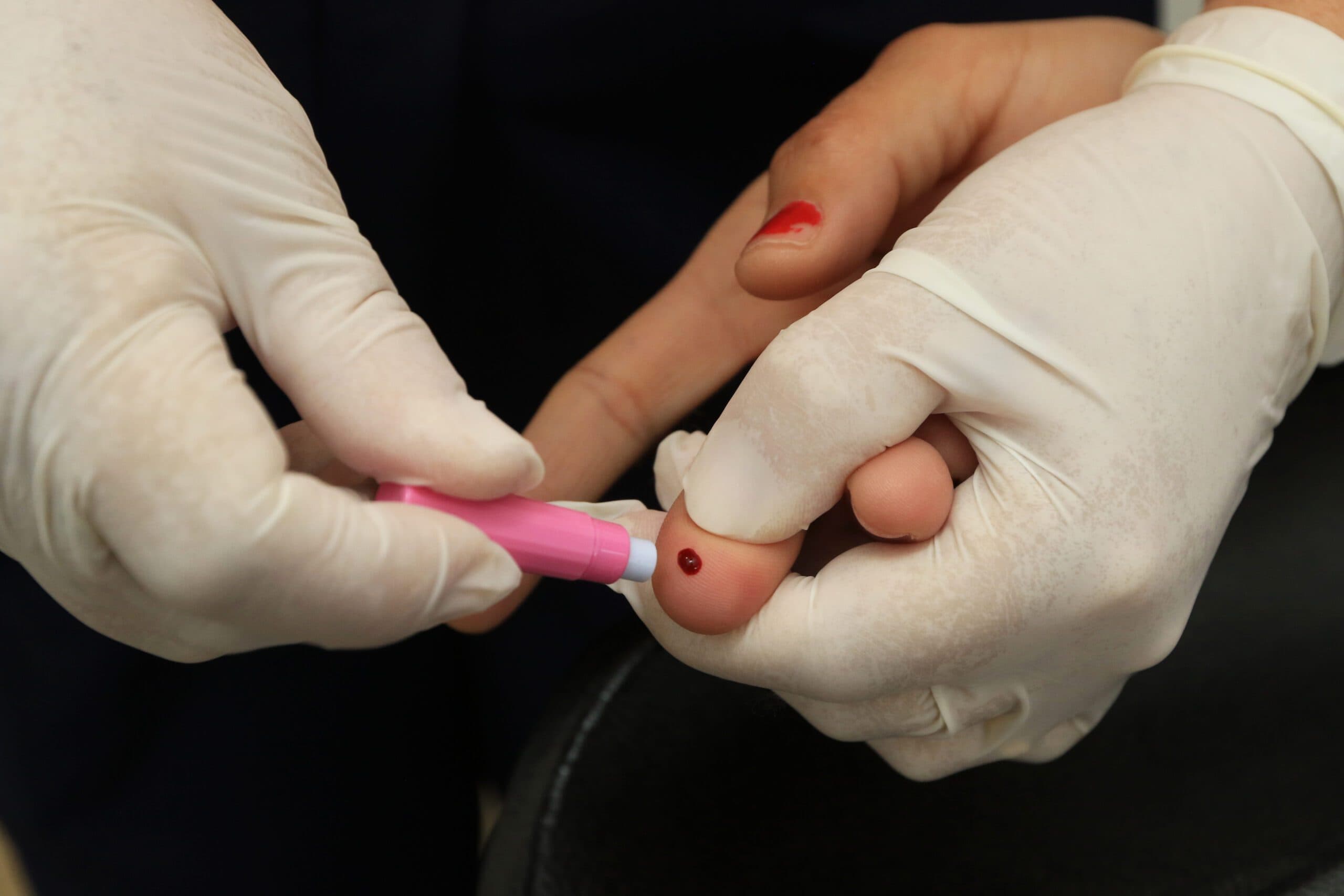 UBS da Asa Norte atua na conscientização sobre HIV e câncer de pele