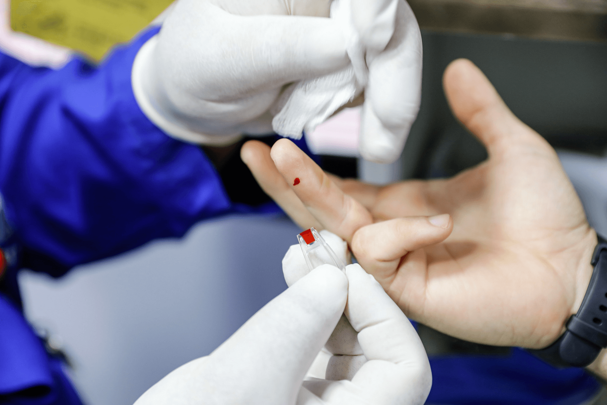 Inscrições abertas para o II Simpósio de Hematologia e Hemoterapia