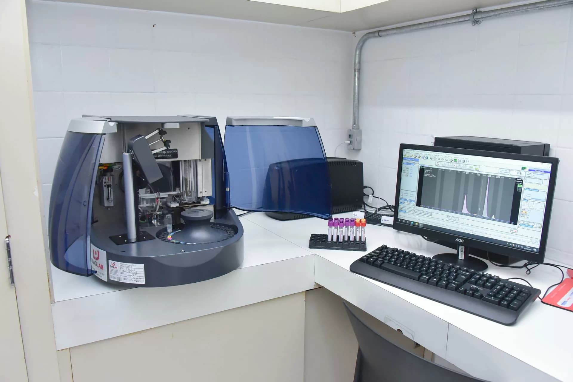 Hospital de Base recebe moderno equipamento para diagnóstico de doenças do sangue