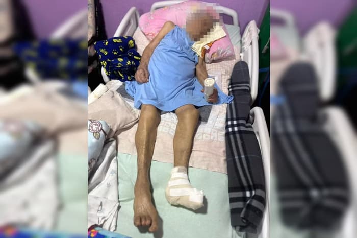 Polícia descarta crime no caso da idosa que teve o pé retirado por enfermeira
