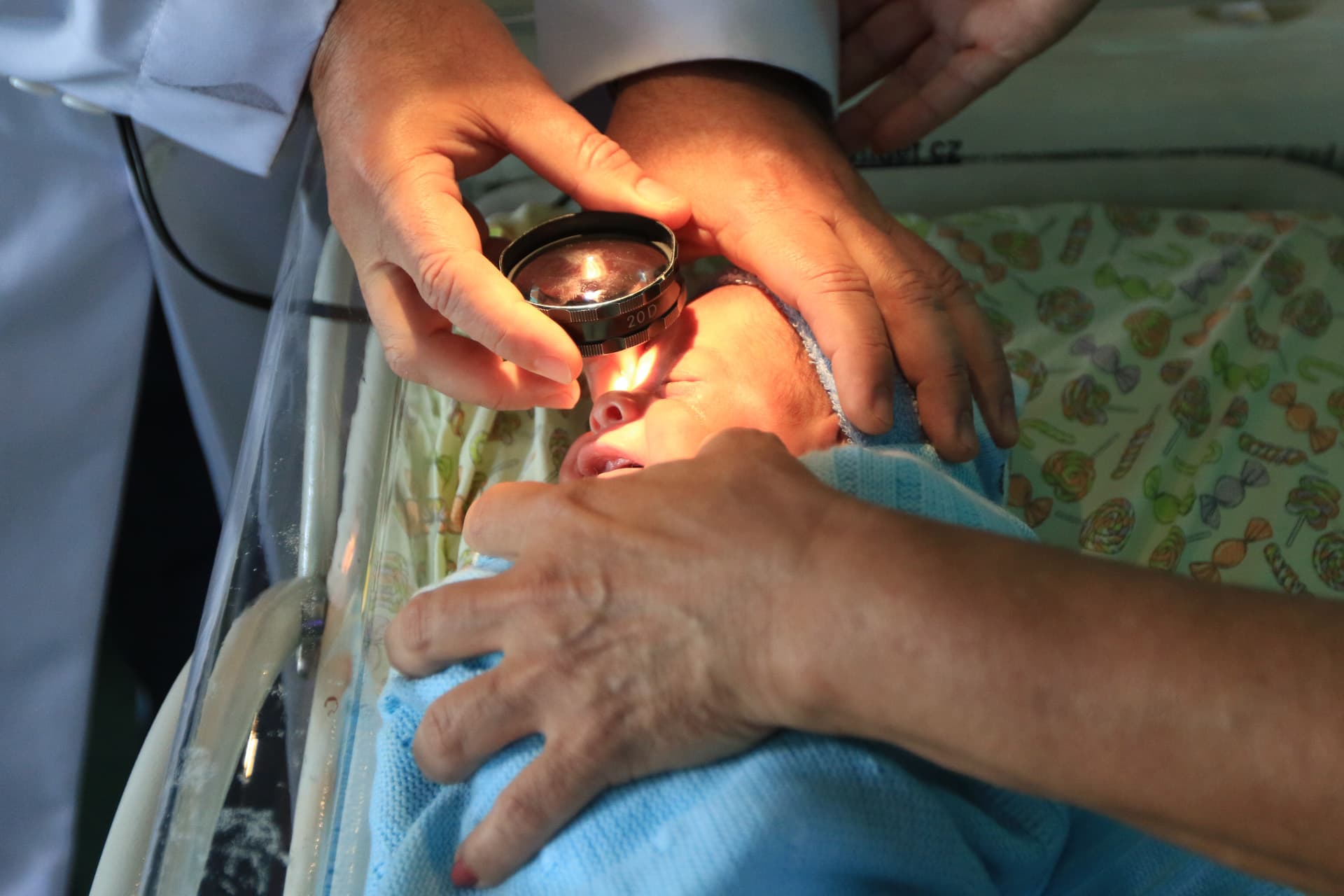 Bebês prematuros recebem atenção oftalmológica específica no HRT