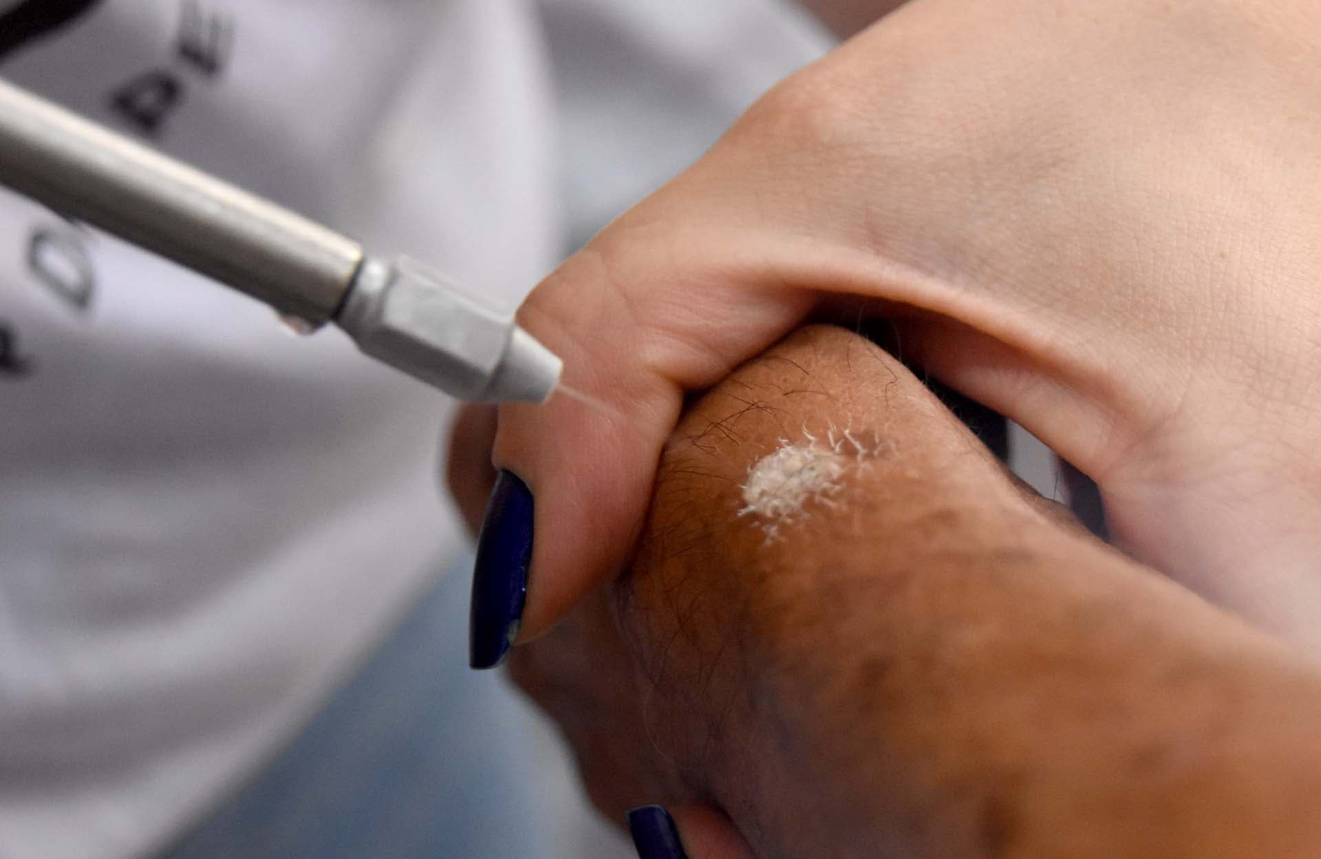 Força-tarefa de dermatologia atende mais de 700 pacientes