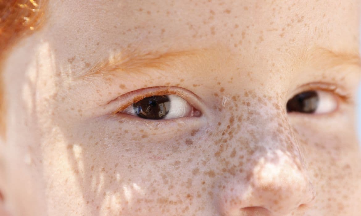 Leucocoria: reflexo branco nos olhos exige atenção imediata e pode salvar vidas