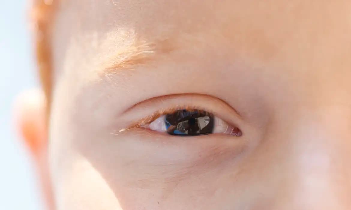 Principal causa de deficiência visual infantil é corrigível, alerta CBO