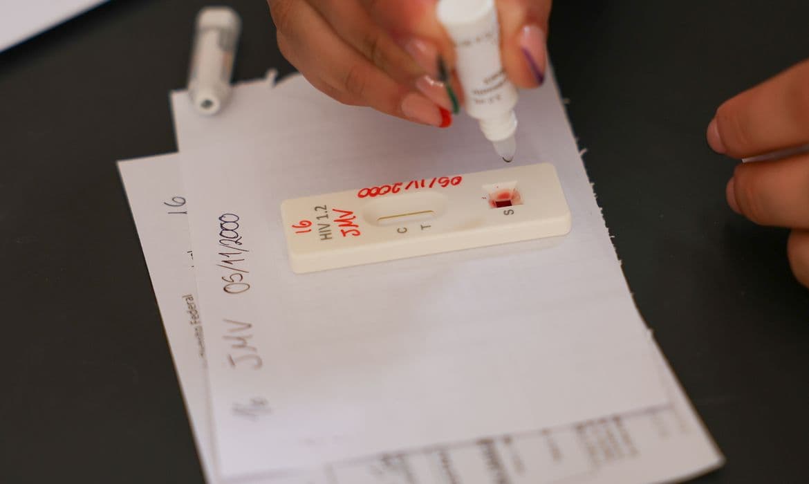 Dezembro Vermelho: DF oferece testagem de HIV gratuita e combate estigma