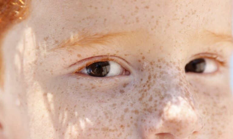 reflexo branco nos olhos