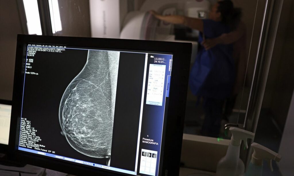 Mamografia SUS 40 anos
