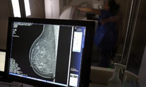 Mamografia SUS 40 anos
