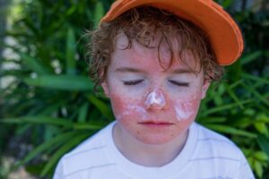 Dezembro Laranja: Protetor Solar Diário Pode Gerar Economia Bilionária no Combate ao Câncer de Pele