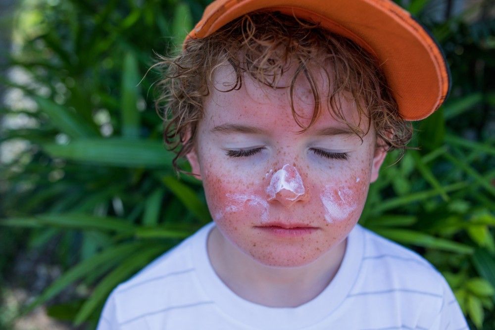 Dezembro Laranja: Protetor Solar Diário Pode Gerar Economia Bilionária no Combate ao Câncer de Pele