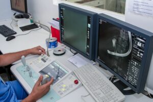 HRT dobra procedimentos de CPRE e aprimora diagnóstico gastrointestinal no DF
