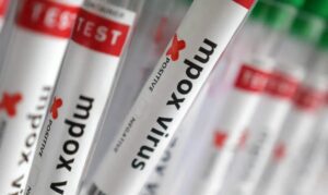 Brasil registra 140 casos confirmados de Mpox em 2026