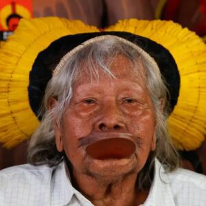 Cacique Raoni apresenta melhora clínica em UTI no Mato Grosso
